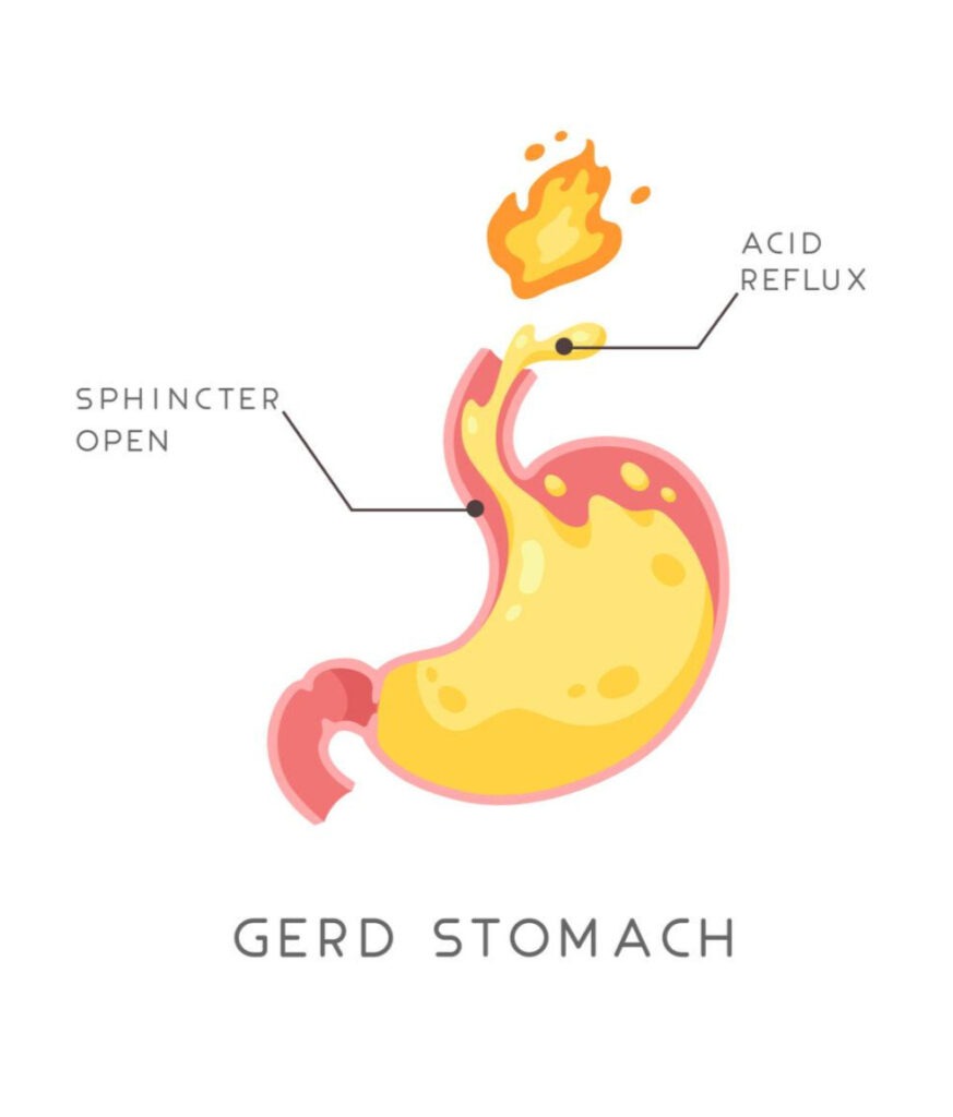 A diagram explaining how Vitamin B12 is absorbed in the stomach via intrinsic factor. It also displays common supplement forms, including methylcobalamin and cyanocobalamin in tablet and sublingual spray formats.