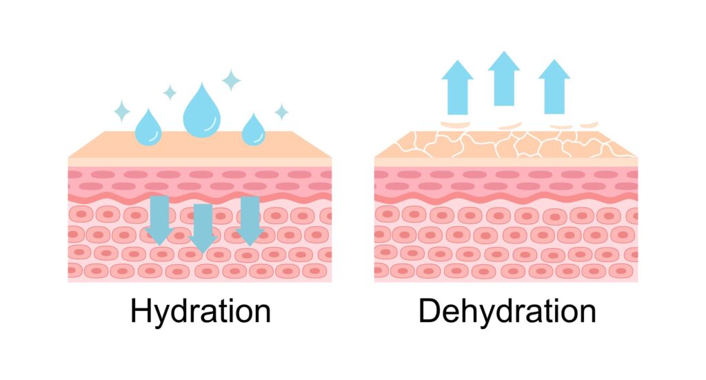 Dry Skin close up showing rough patches and dehydrated skin