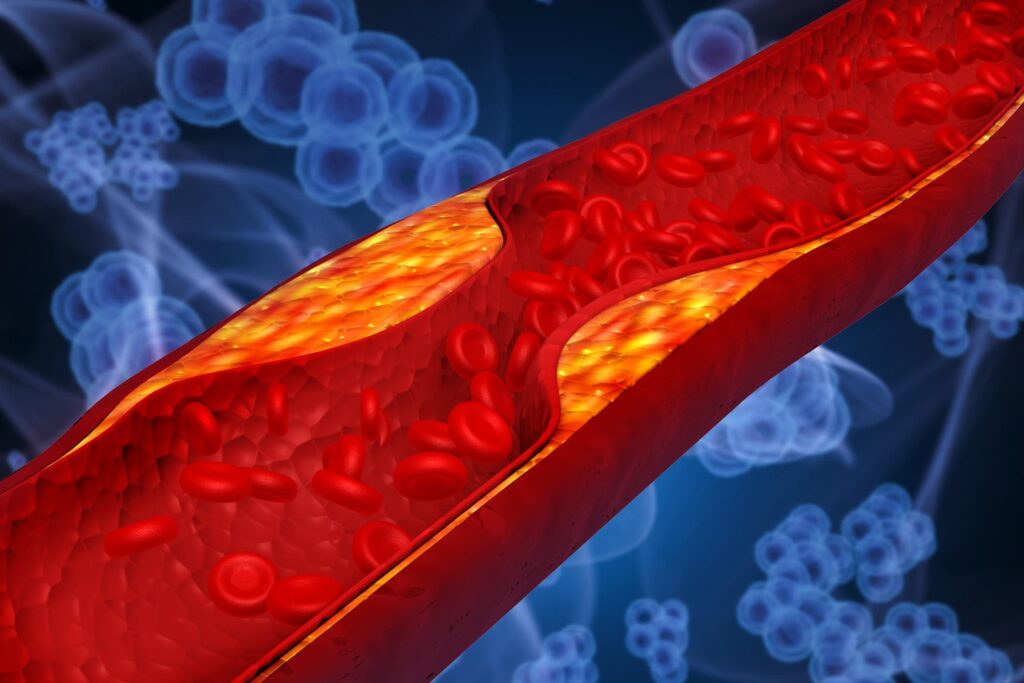 A close-up of a digital blood pressure monitor showing numerical readings for systolic and diastolic pressure, symbolizing the monitoring of hypertension and heart health.