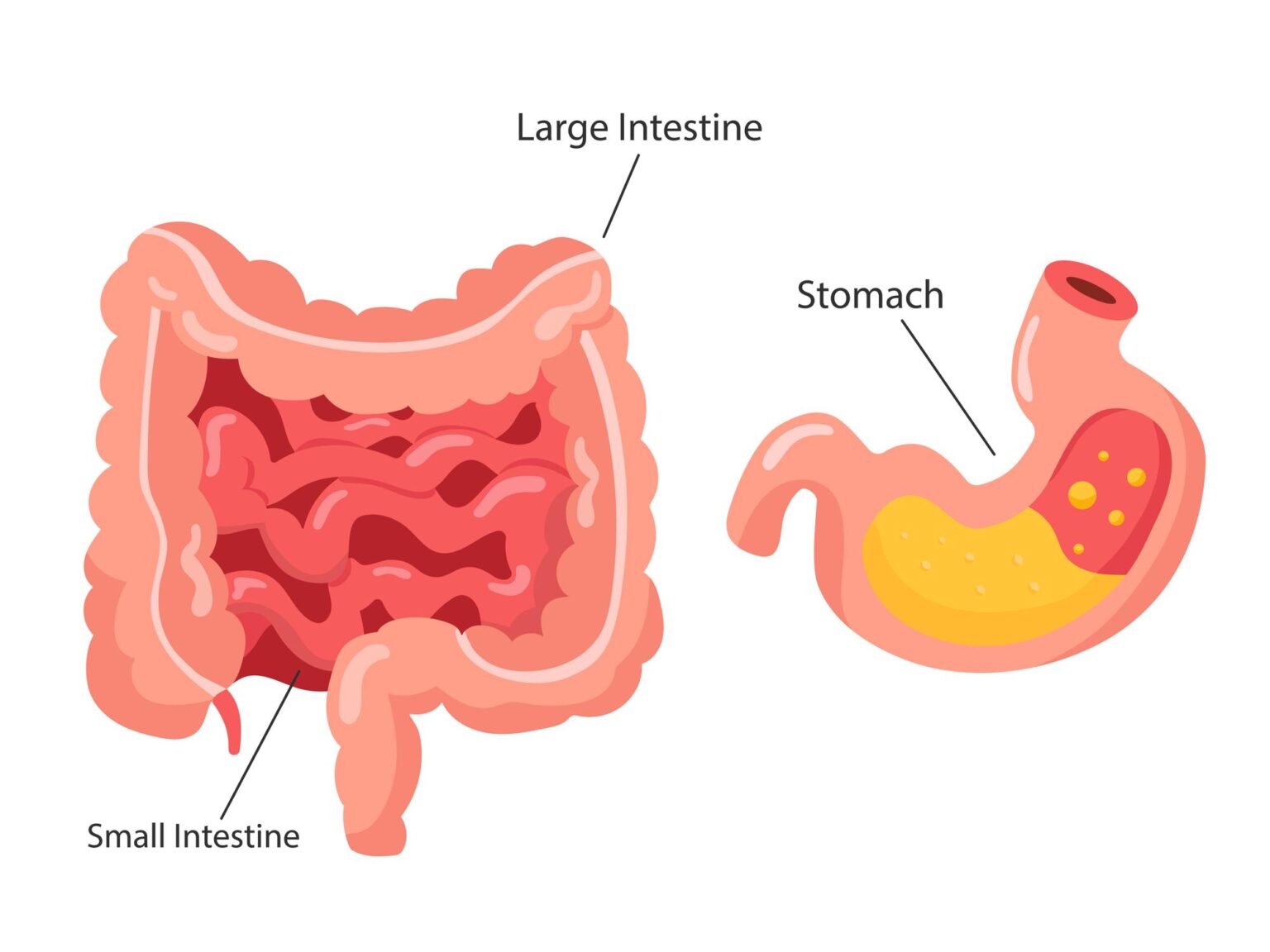 An anatomical illustration of the human digestive system highlighting the stomach, small intestine, and large intestine. The diagram shows a cross-section of the stomach containing yellow gastric fluids and red irritation to represent indigestion and acid reflux, alongside a detailed view of the intestinal tract.