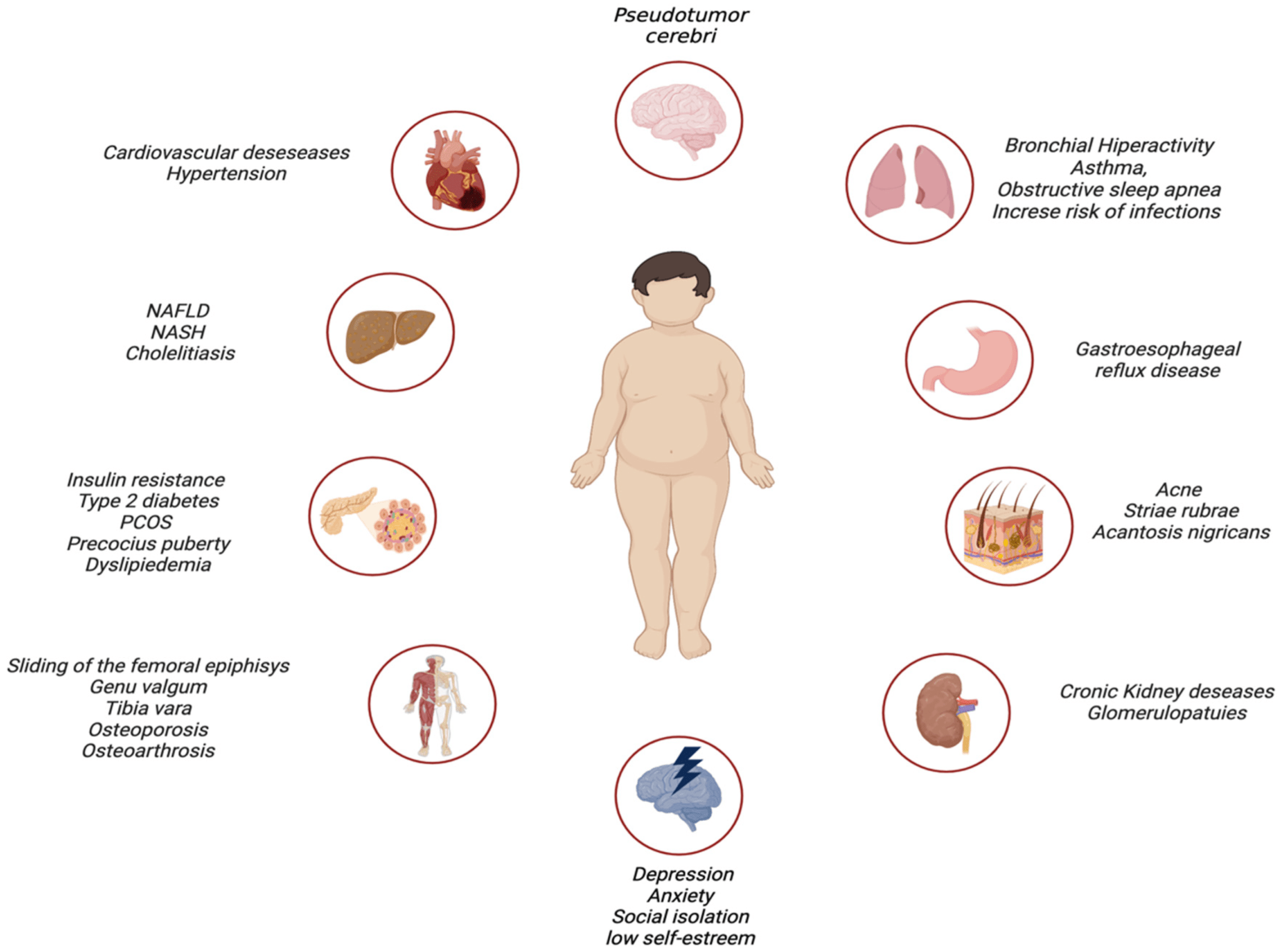 A side-by-side comparison showing clinical signs of malnutrition in a child, including a distended abdomen (kwashiorkor) and visible rib cage (marasmus).