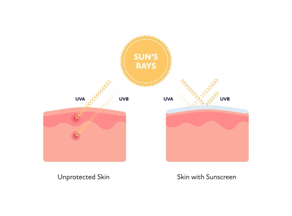 Pigmentation on face showing dark spots and uneven skin tone